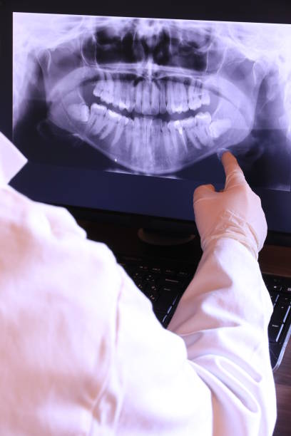Best Emergency Dental Care for Broken or Chipped Teeth in Kenneth City, FL